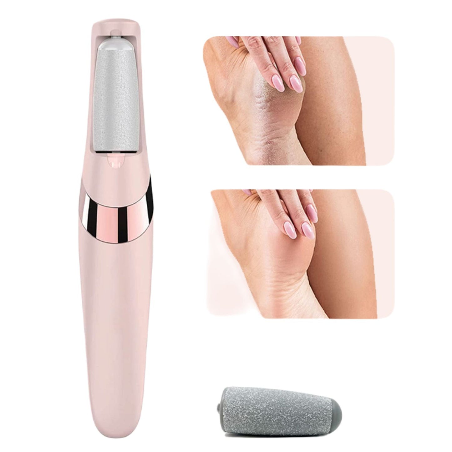 Electric Foot File