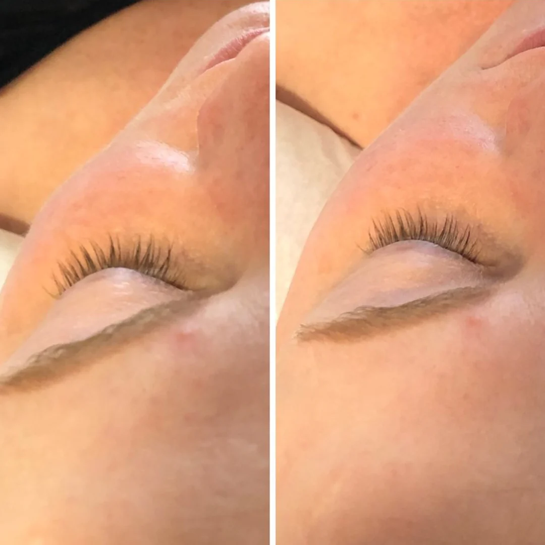 Facial Ice Globes