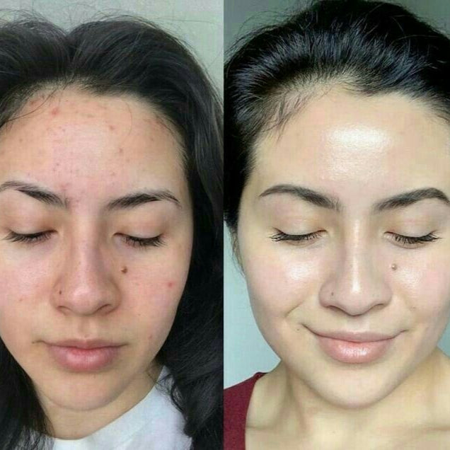 Professional Facial Steamer
