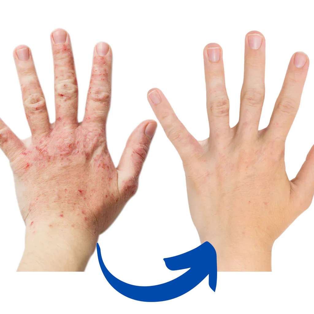 Red light gloves for hands and fingers