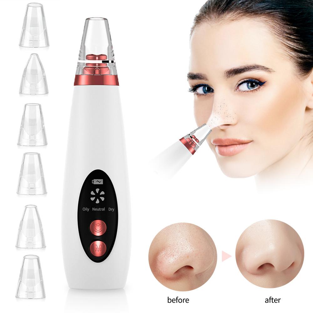 Blackhead Remover Kit