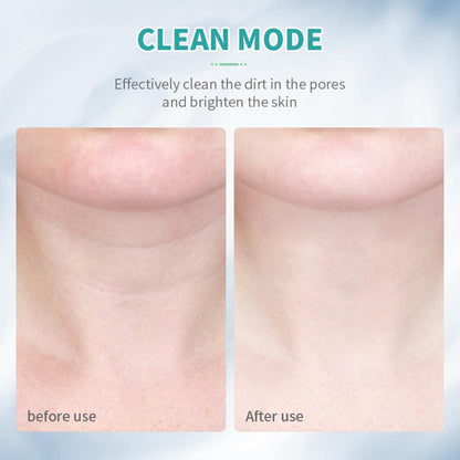EMS Microcurrent Face Neck Lifting Massager