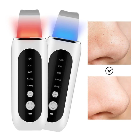 Deep Cleansing Pore Minimizer & Blackhead Remover - Glamry