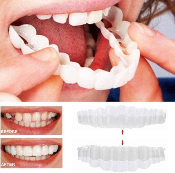 Custom Dental Night Guard for Tooth Protection - Glamry