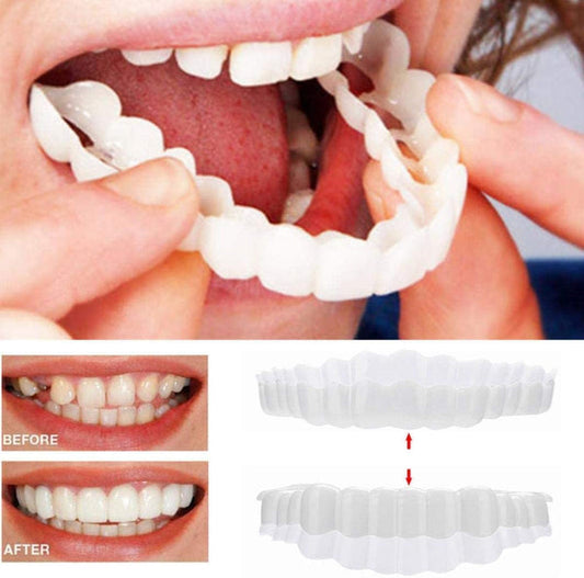 Custom Dental Night Guard for Tooth Protection - Glamry